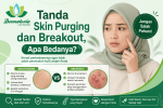 Tanda Skin Purging dan Breakout